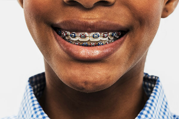 Woodhaven Braces | Digital Radiography,  Early Treatment and Orthodontics for Young Adults